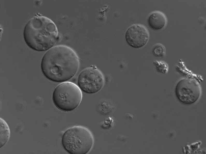 DIC microscopy of Histomonas meleagridis trophozoites